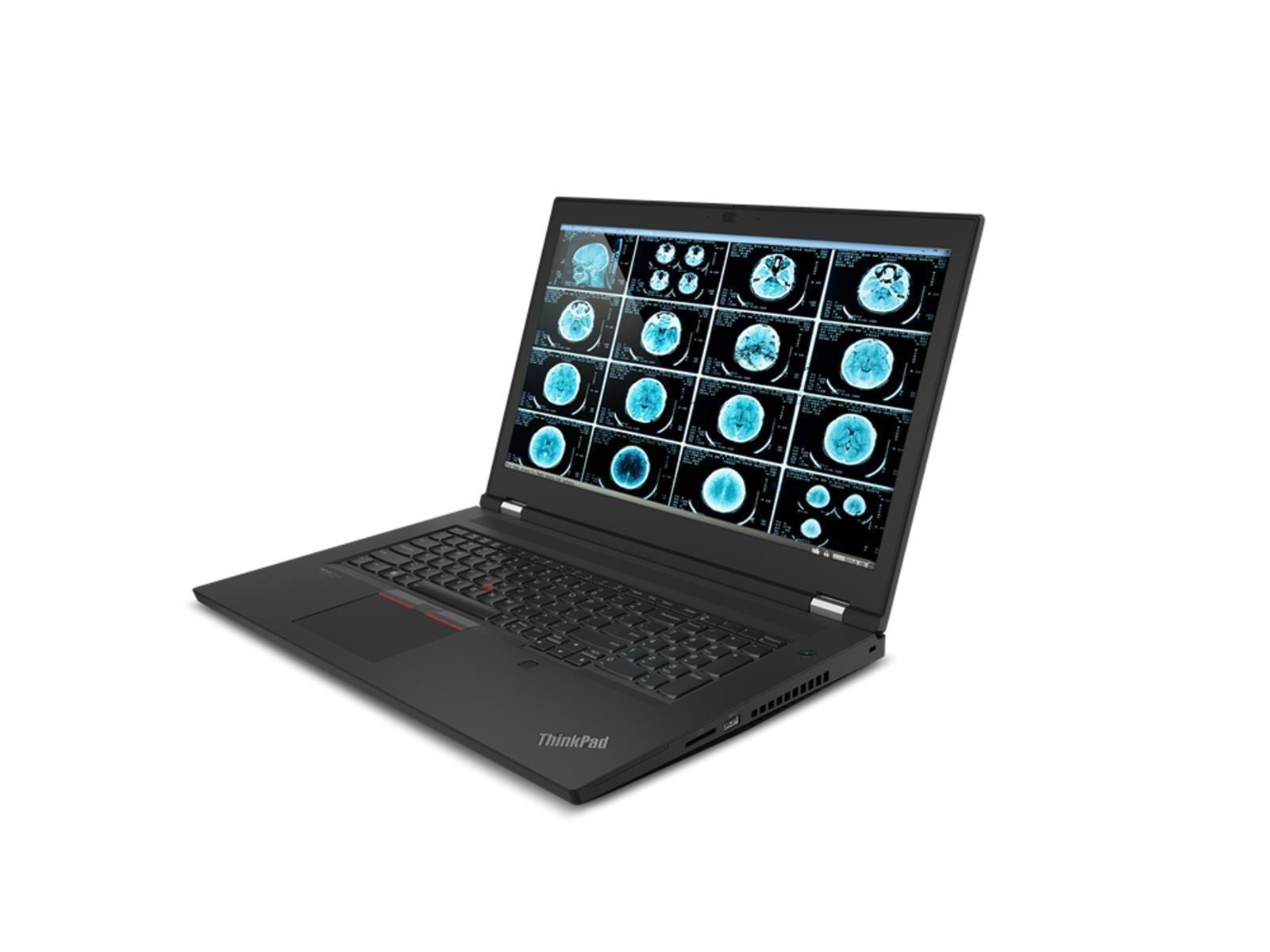 Schwarzer ThinkPad-Laptop mit medizinischen Gehirnscans. Tastatur sichtbar. Weißer Hintergrund.