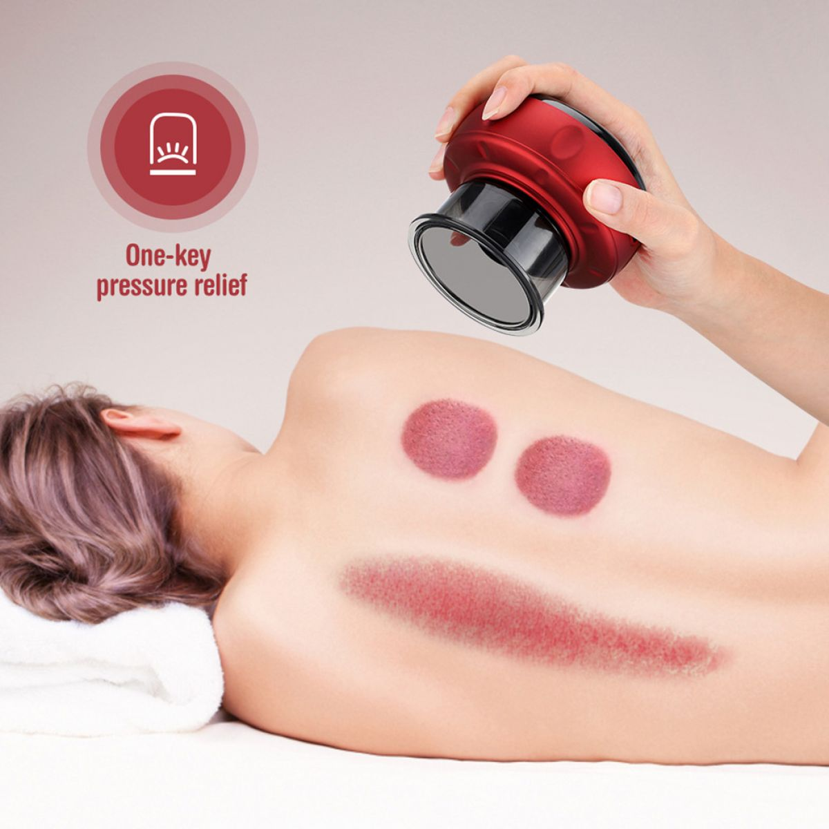 Eine Person erhält eine Schröpftherapie. Ein rotes Gerät wird über dem Rücken gehalten, wobei Schröpfspuren sichtbar sind.