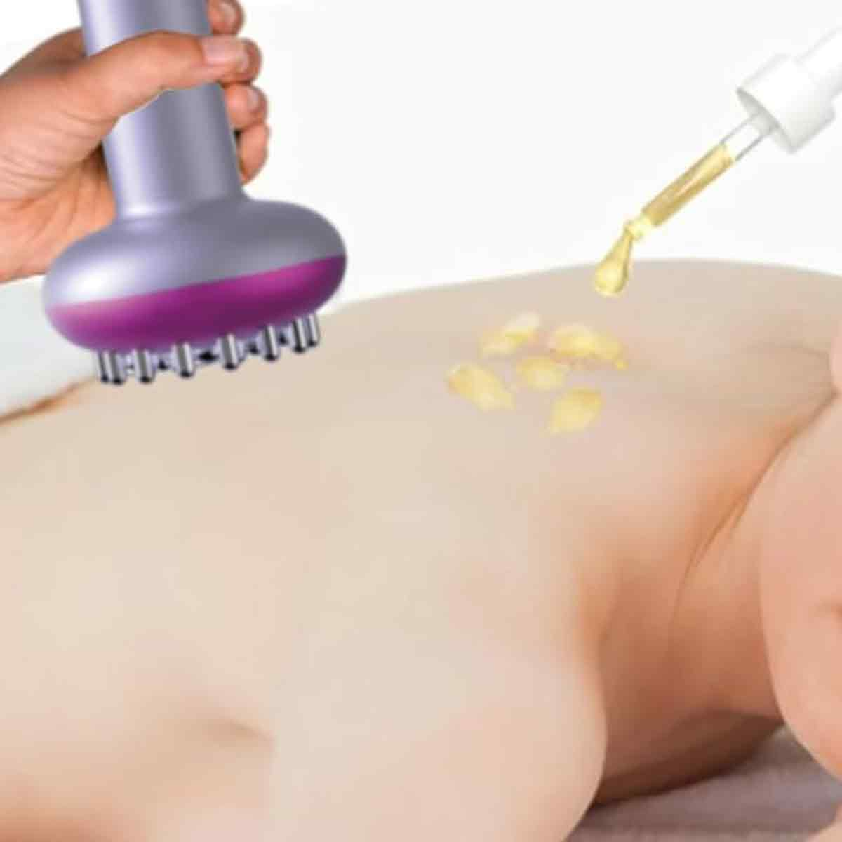 Eine Hand hält ein Massagegerät in der Nähe eines Körpers. Öl tropft aus einer Pipette auf die Haut. Das Werkzeug hat lila und silberne Teile.