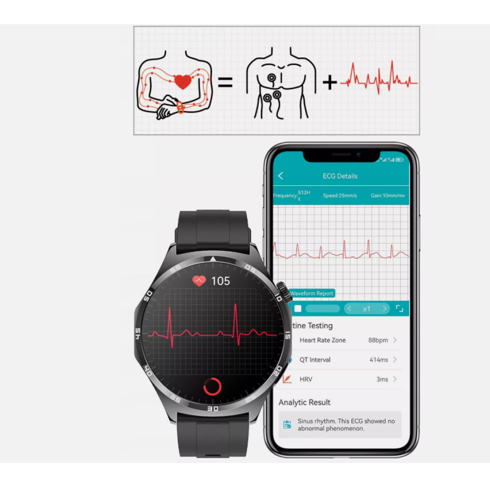 Diagramm mit Herzanatomie und EKG-Wellenform, angezeigt auf Smartwatch und Smartphone. Ergebnisse zeigen normalen Sinusrhythmus.