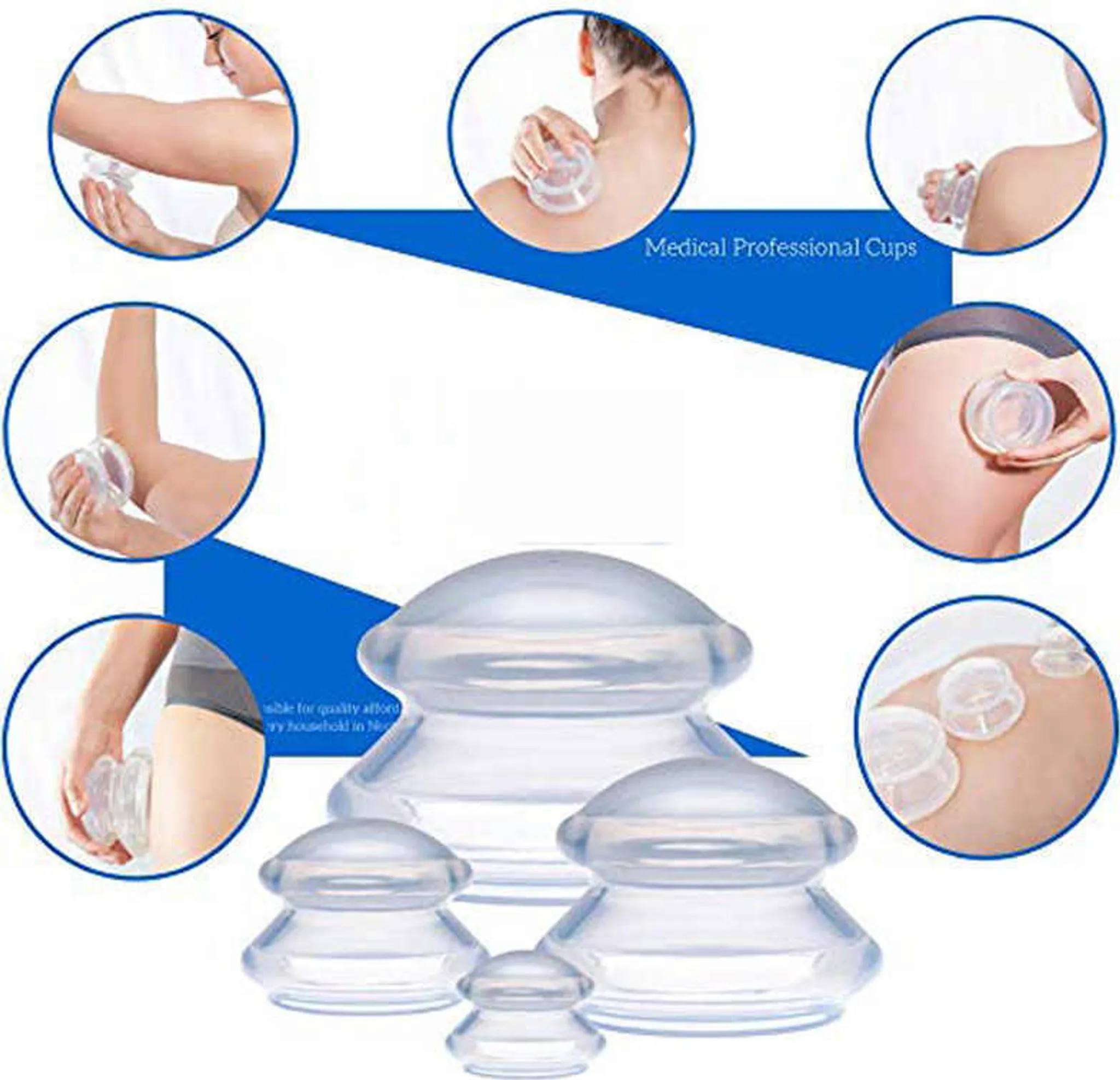 Das Bild zeigt Schröpftherapie-Cups und Menschen, die sie auf verschiedenen Körperteilen verwenden. Die Cups sind aus klarem Kunststoff.