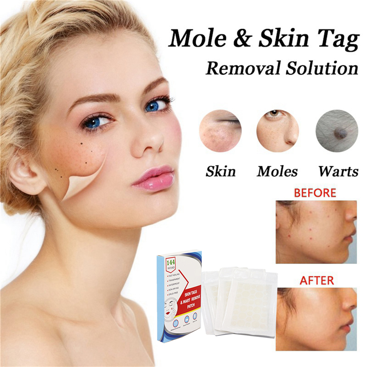 Das Gesicht einer Frau mit Peeling-Effekt, der die Entfernung von Hautanhängseln zeigt. Produktverpackung und Vorher-/Nachher-Hautbeispiele werden ebenfalls gezeigt.