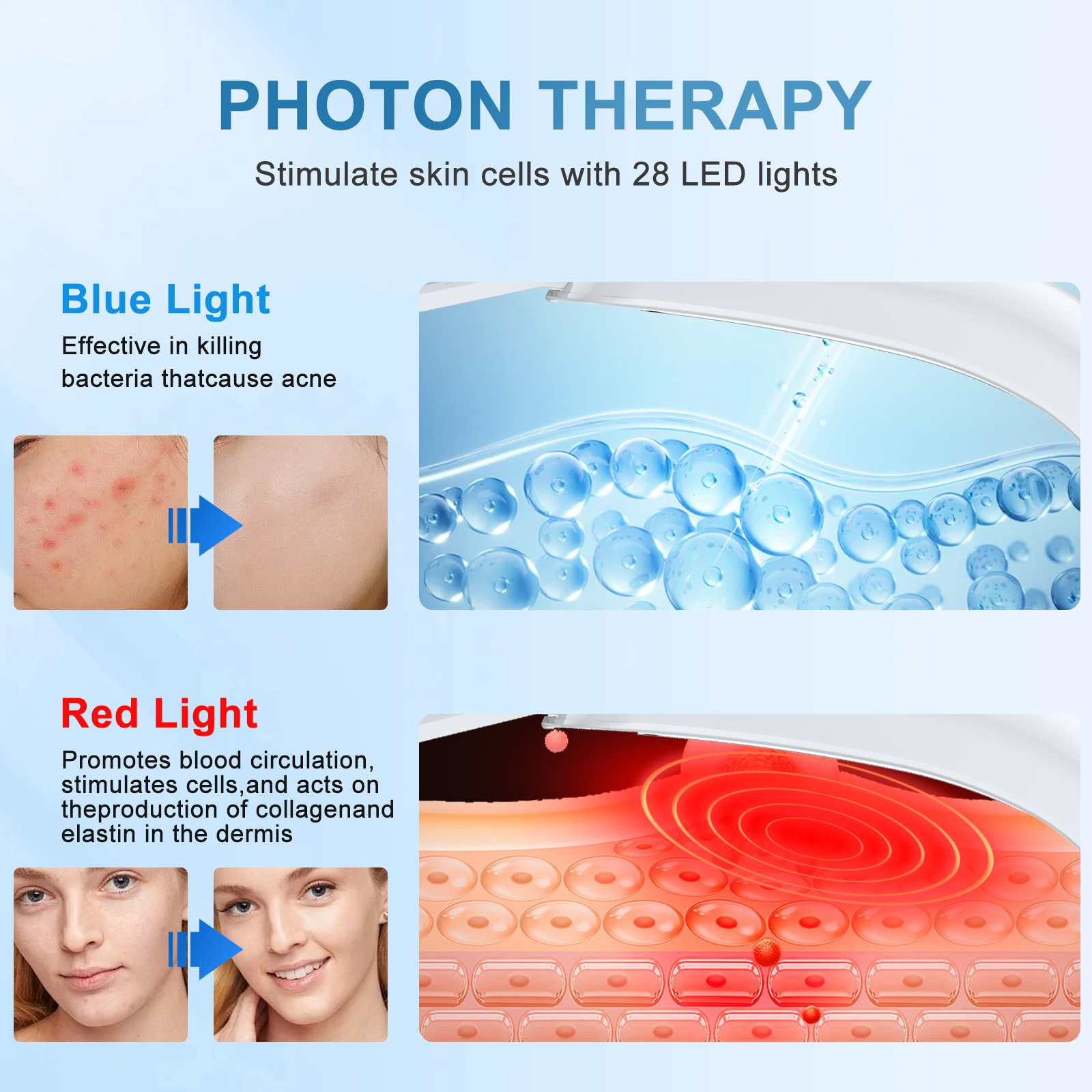 Das Bild zeigt Photonentherapie mit Blau- und Rotlichtbehandlungen. Text erklärt ihre Auswirkungen auf die Haut.