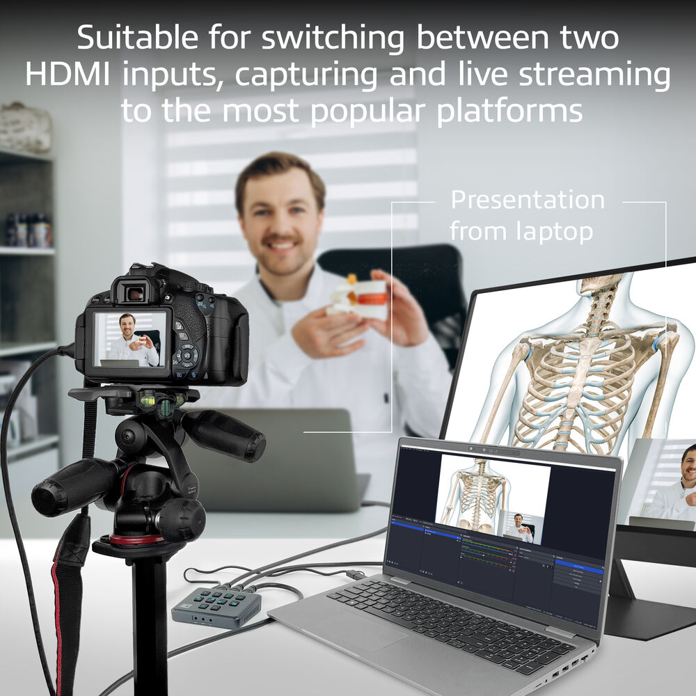 Ein Mann hält ein Modell, eine Kamera auf einem Stativ, einen Laptop und einen Monitor mit einem Skelett. Für HDMI-Eingang und Streaming.