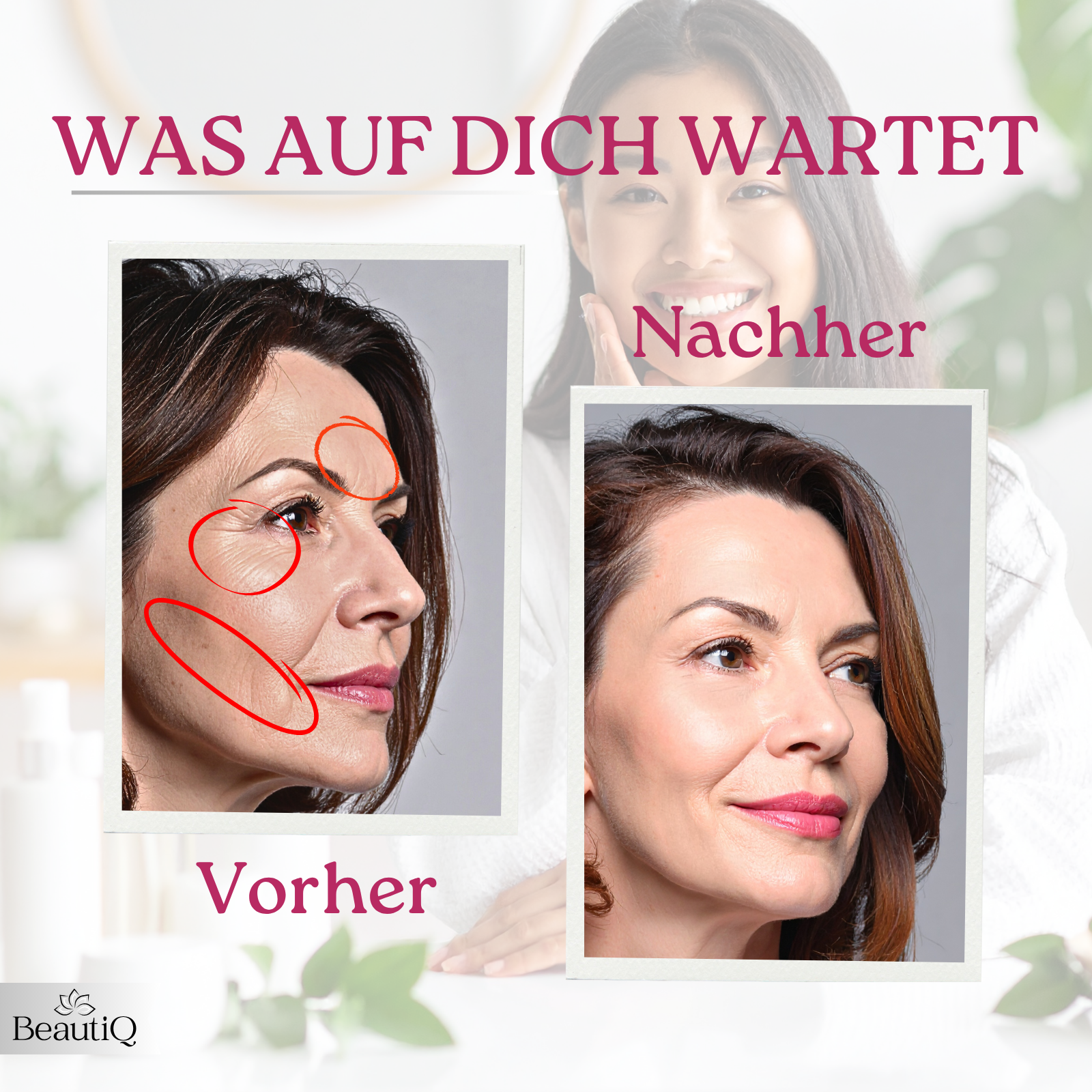 Vergleich Vorher-Nachher Gesichtshaut. Links Falten rot markiert. Rechts glattere Haut.