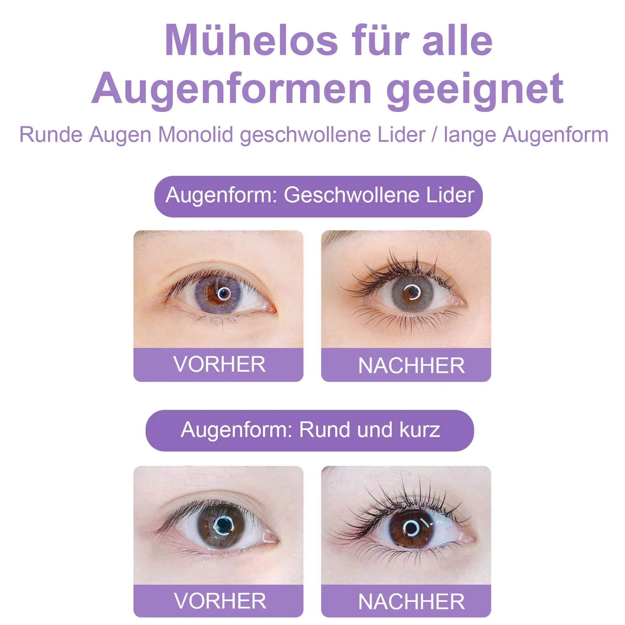 Das Bild zeigt Augen vor und nach Behandlungen. Text besagt: geeignet für alle Augenformen. Beinhaltet geschwollene Lider und kurze Augen.