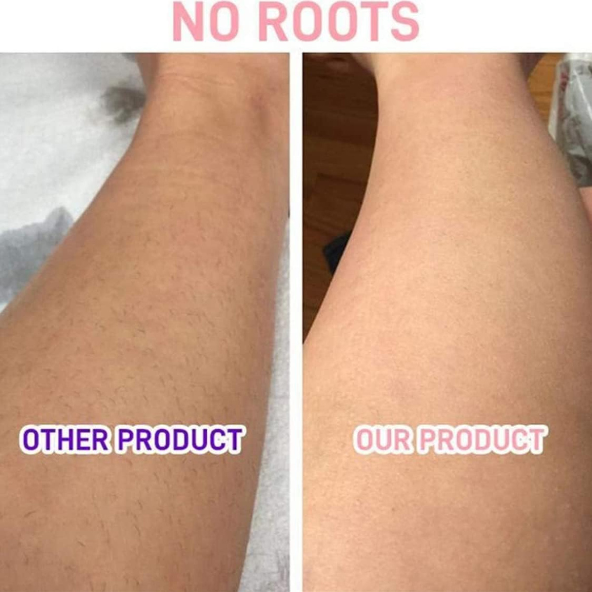Vergleich zweier Beine. Ein Bein hat Haare, beschriftet mit 'Other Product'. Das andere Bein ist glatt, beschriftet mit 'Our Product', mit Text 'NO ROOTS'.