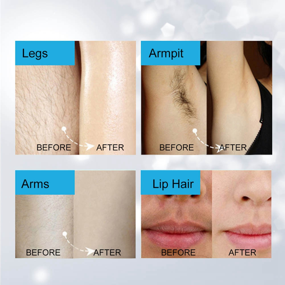 Das Bild zeigt Körperteile mit und ohne Haare: Beine, Achseln, Arme und Lippenhaare. Jedes Paar zeigt einen 'Vorher'- und 'Nachher'-Vergleich.