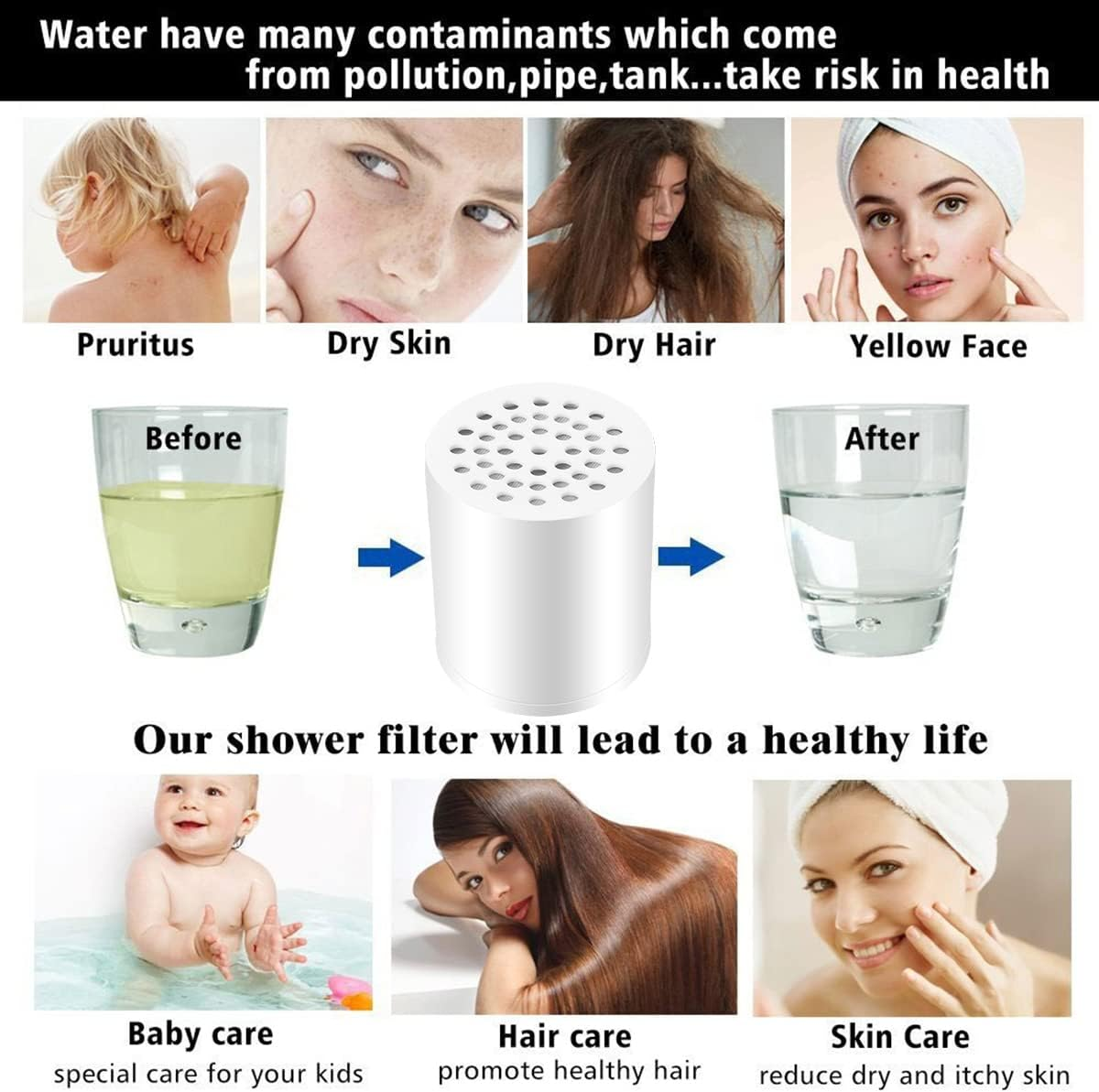 Das Bild zeigt Gesundheitsprobleme: Juckreiz, trockene Haut, trockenes Haar, gelbes Gesicht. Es bewirbt einen Duschfilter für Baby-, Haar- und Hautpflege.