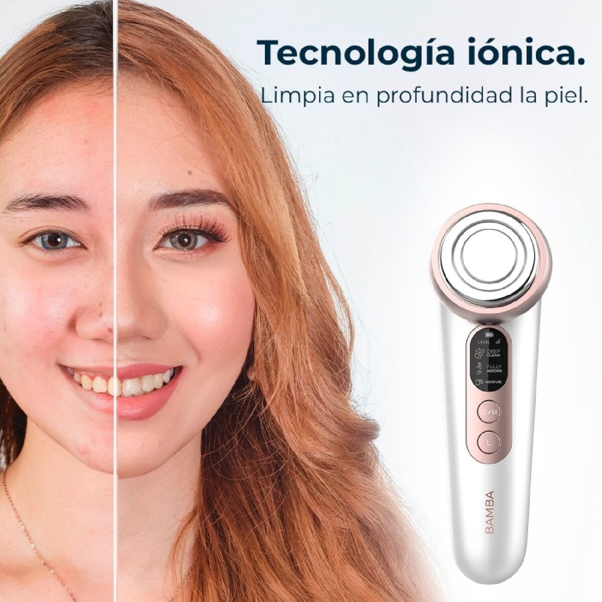 La imagen muestra la cara de una mujer dividida por la mitad. Un lado tiene imperfecciones, el otro está limpio. Se muestra un dispositivo para el cuidado de la piel.