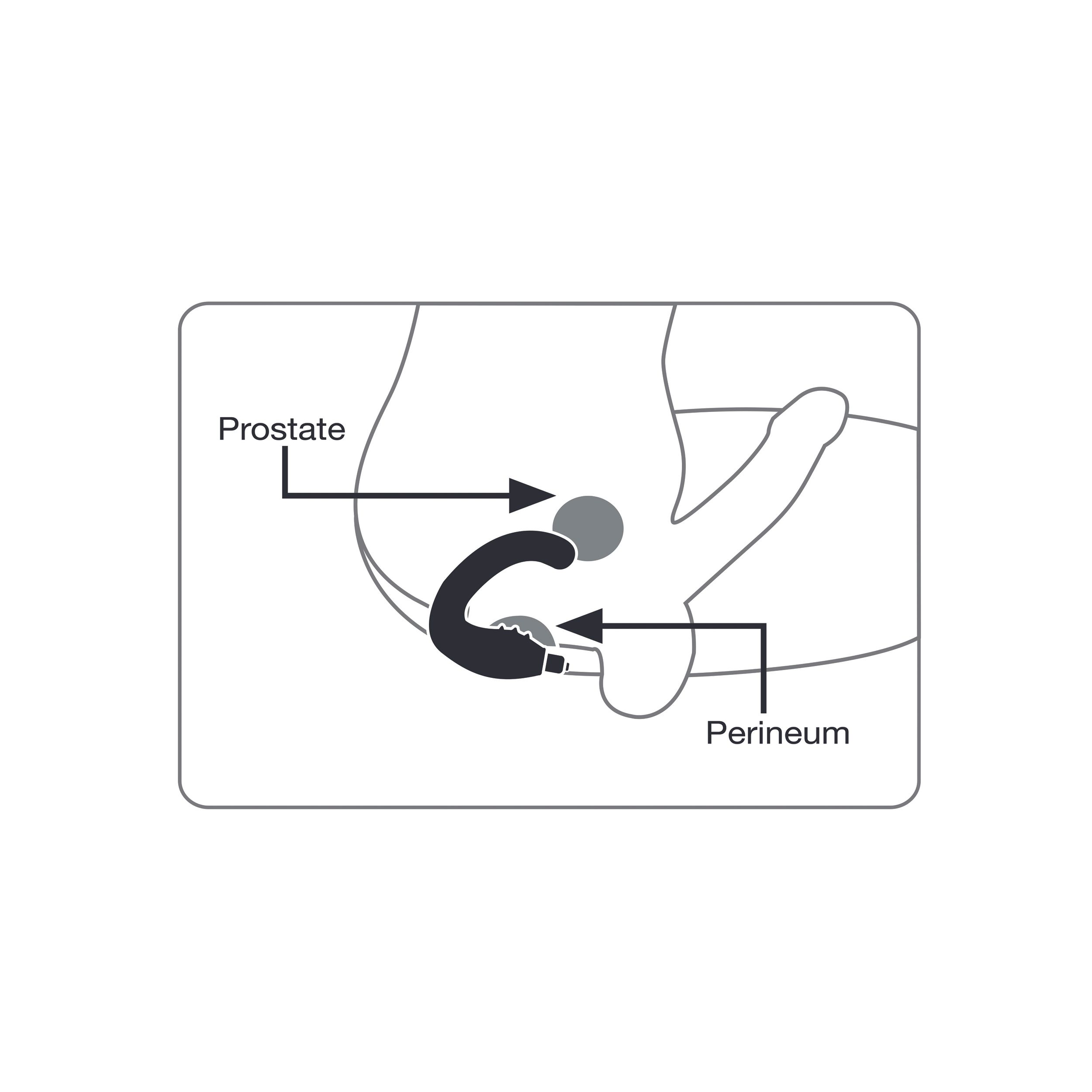 Diagramm zeigt Prostata und Damm, mit Beschriftungen und Pfeilen, die ihre Positionen anzeigen.