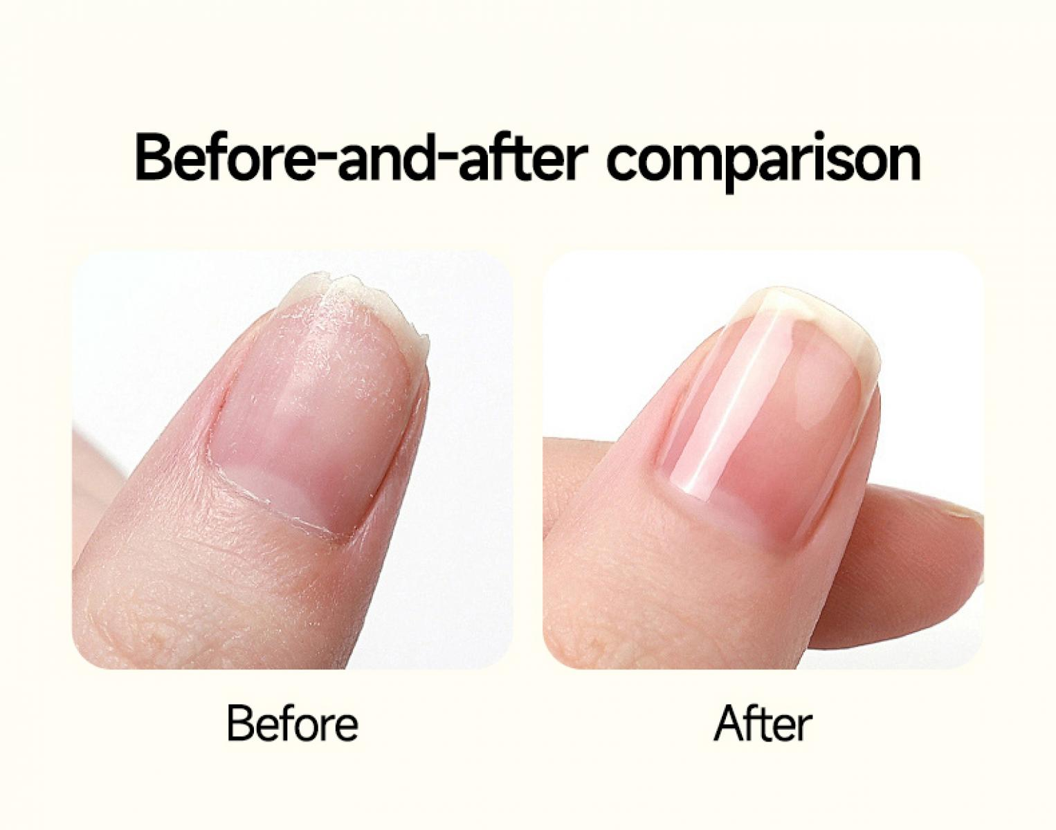 Vorher-Nachher-Vergleich: Ein gesplitterter Fingernagel links, ein gepflegter rechts.