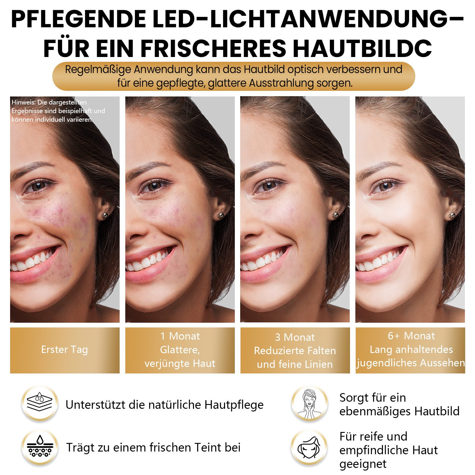 Vier Bilder, die ein Frauengesicht mit verbesserter Haut im Laufe der Zeit zeigen. Vom ersten Tag bis über 6 Monate.