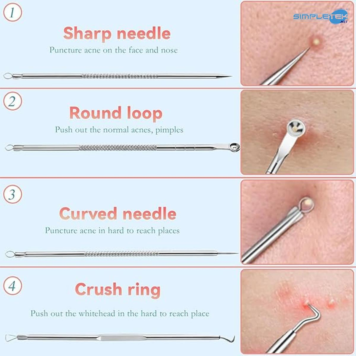 Quattro strumenti per la rimozione dell'acne: ago affilato, anello rotondo, ago curvo, anello schiacciante.