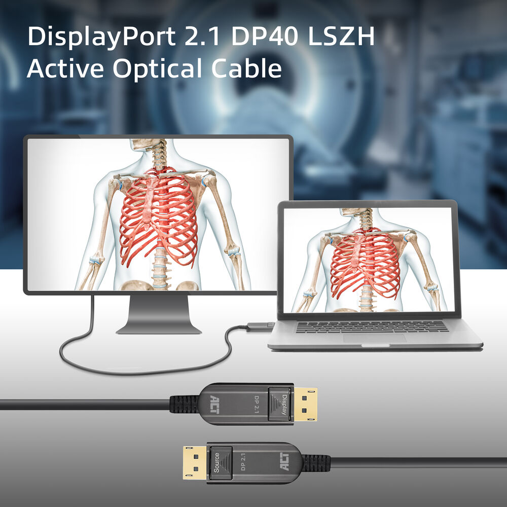 DisplayPort 2.1 Kabel verbindet Monitor und Laptop mit menschlichem Skelett.