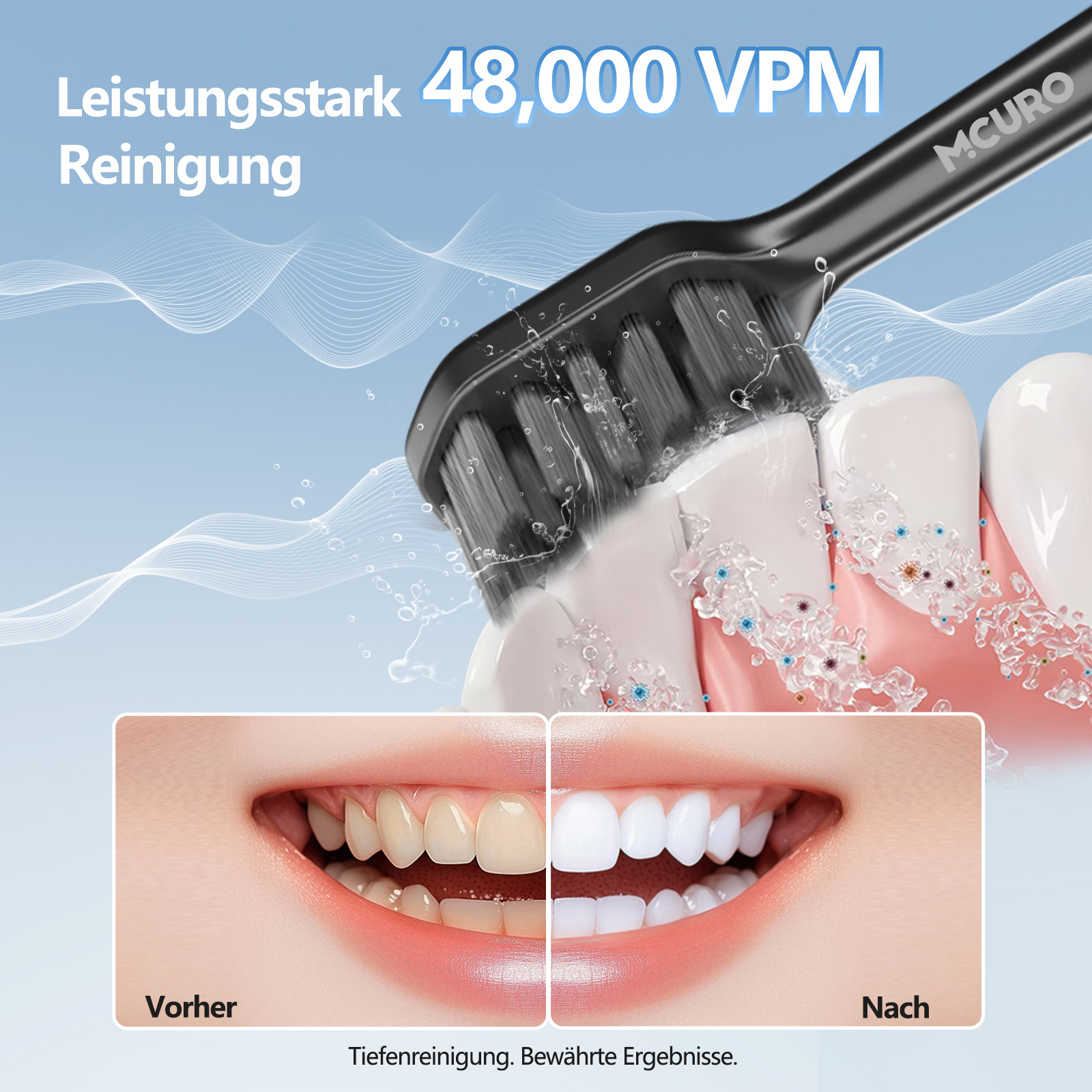 Elektrische Zahnbürste reinigt Zähne mit 48.000 VPM. Vorher/Nachher Vergleich.
