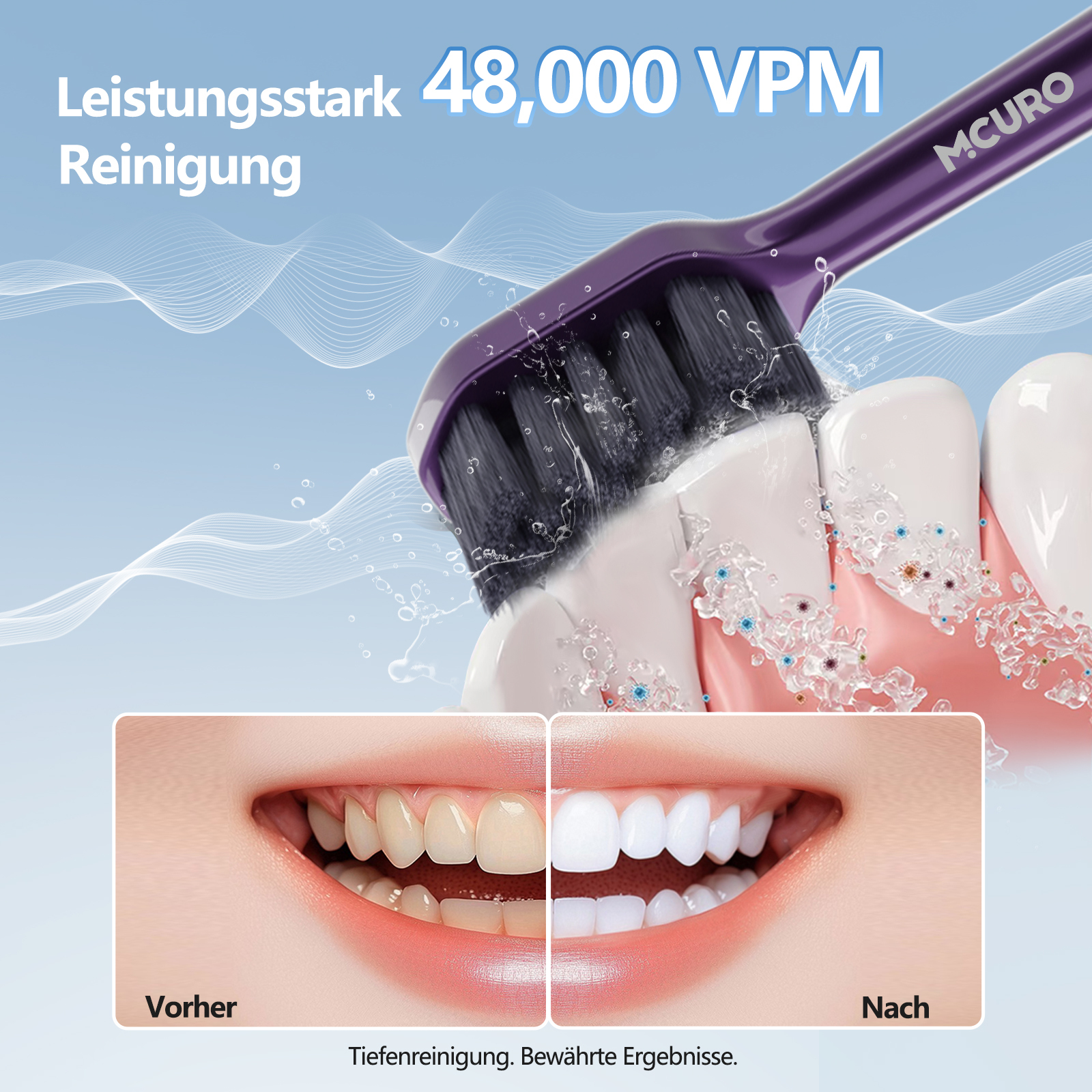 Elektrische Zahnbürste mit 48.000 VPM reinigt Zähne. Vorher/Nachher-Vergleich.