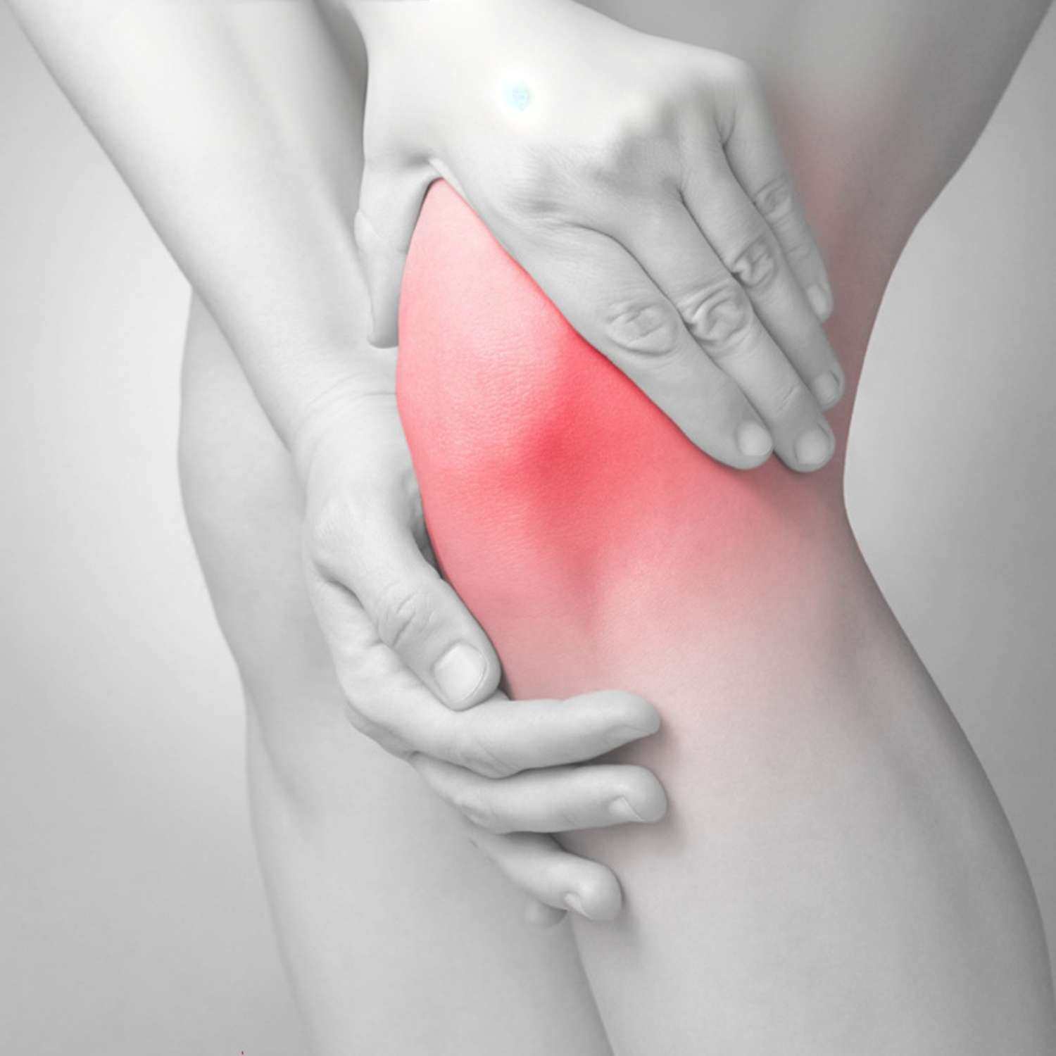 Schmerzende Knie: Hände umfassen die rote, entzündete Kniescheibe.