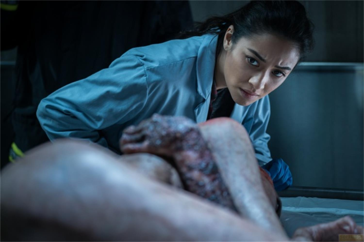 Una donna in camice da laboratorio blu esamina un corpo ustionato.