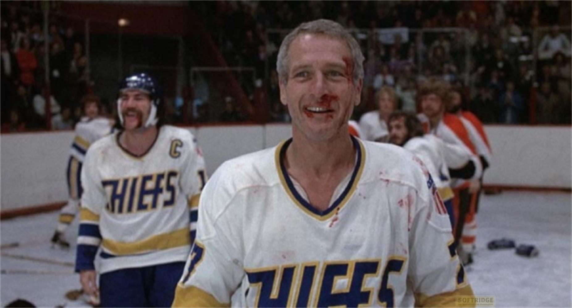 Un joueur de hockey ensanglanté sourit, avec des joueurs en arrière-plan.