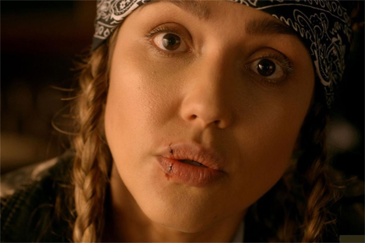 Una donna con bandana e trecce ha un taglio sul labbro.