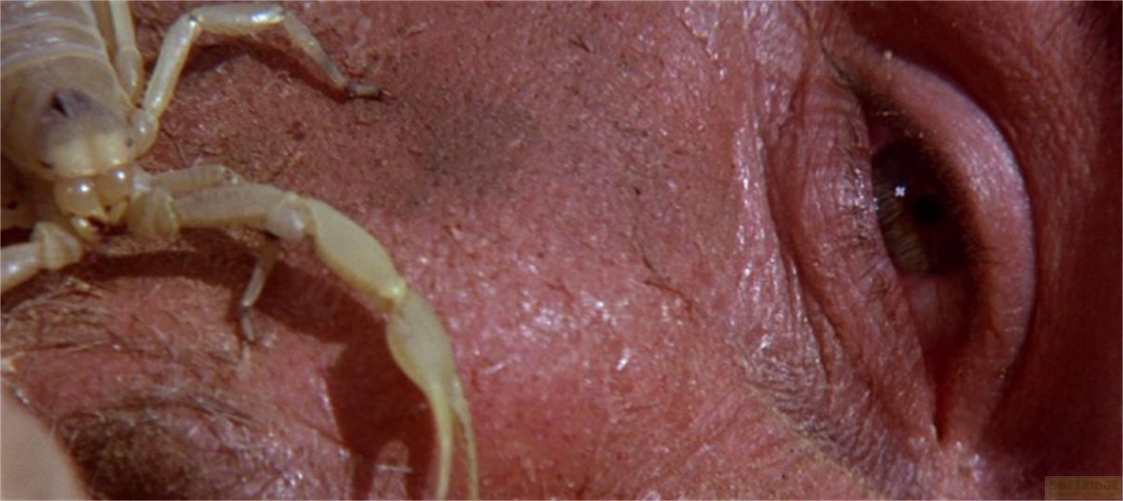 Uno scorpione di colore chiaro striscia sulla pelle accanto a un occhio umano.