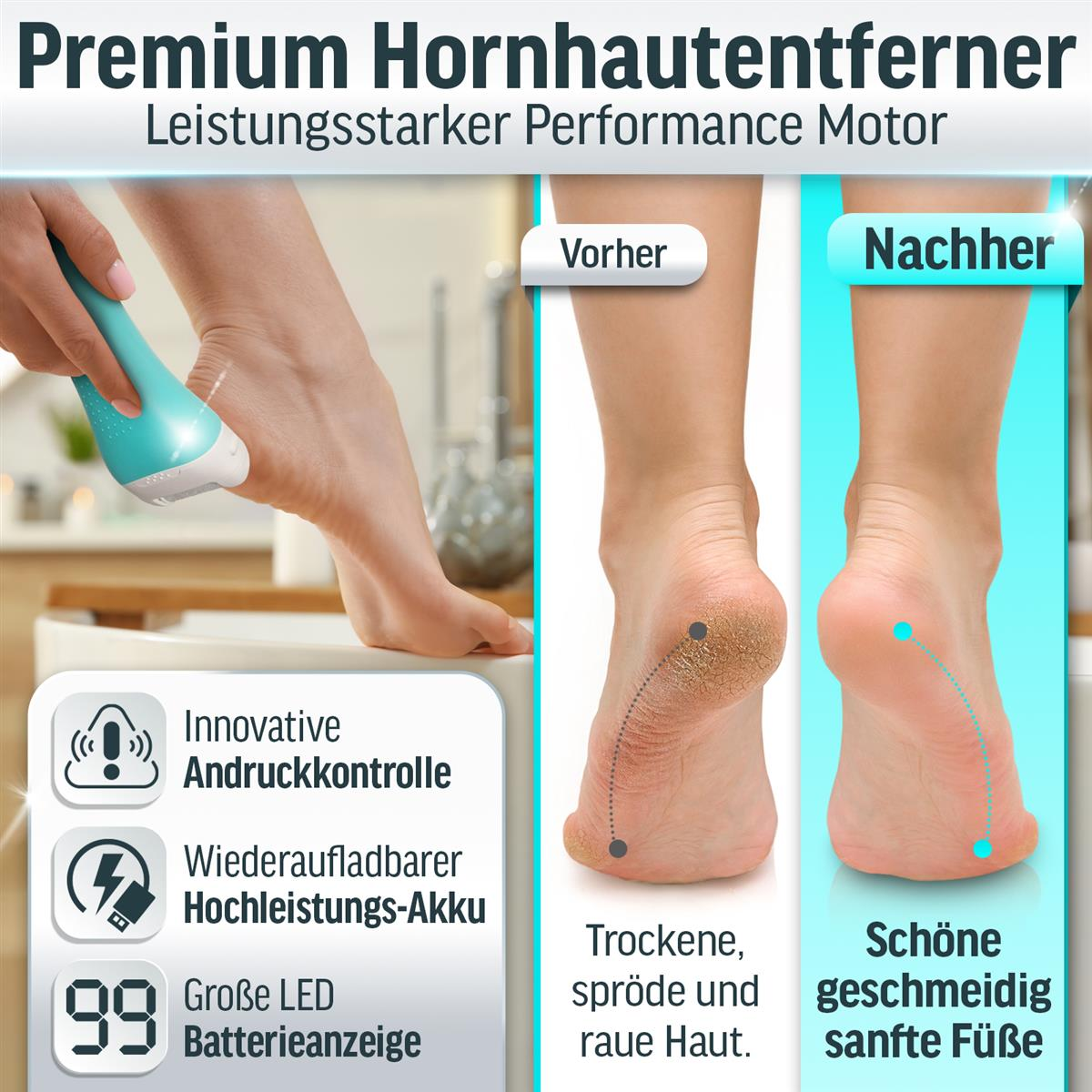 Produktbild: Hornhautentferner mit Vorher/Nachher-Fußbildern und Produktmerkmalen.