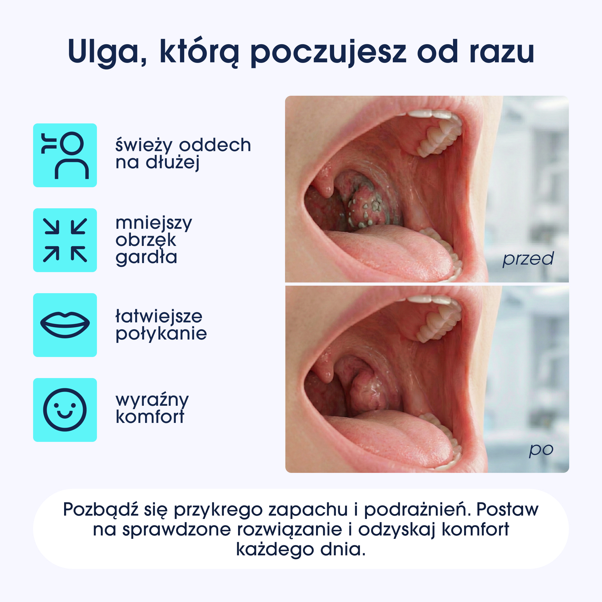 Widok gardła przed i po, z migdałkami z nalotem, potem czystymi.