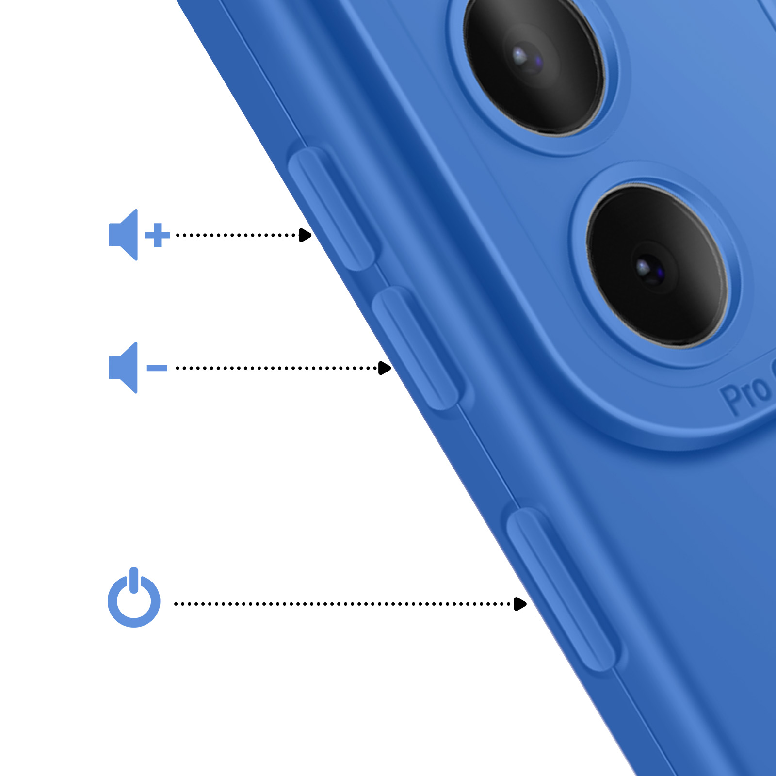 Blauw hoesje met volume- en aan/uit-knoppen. Cameramodule bovenaan.