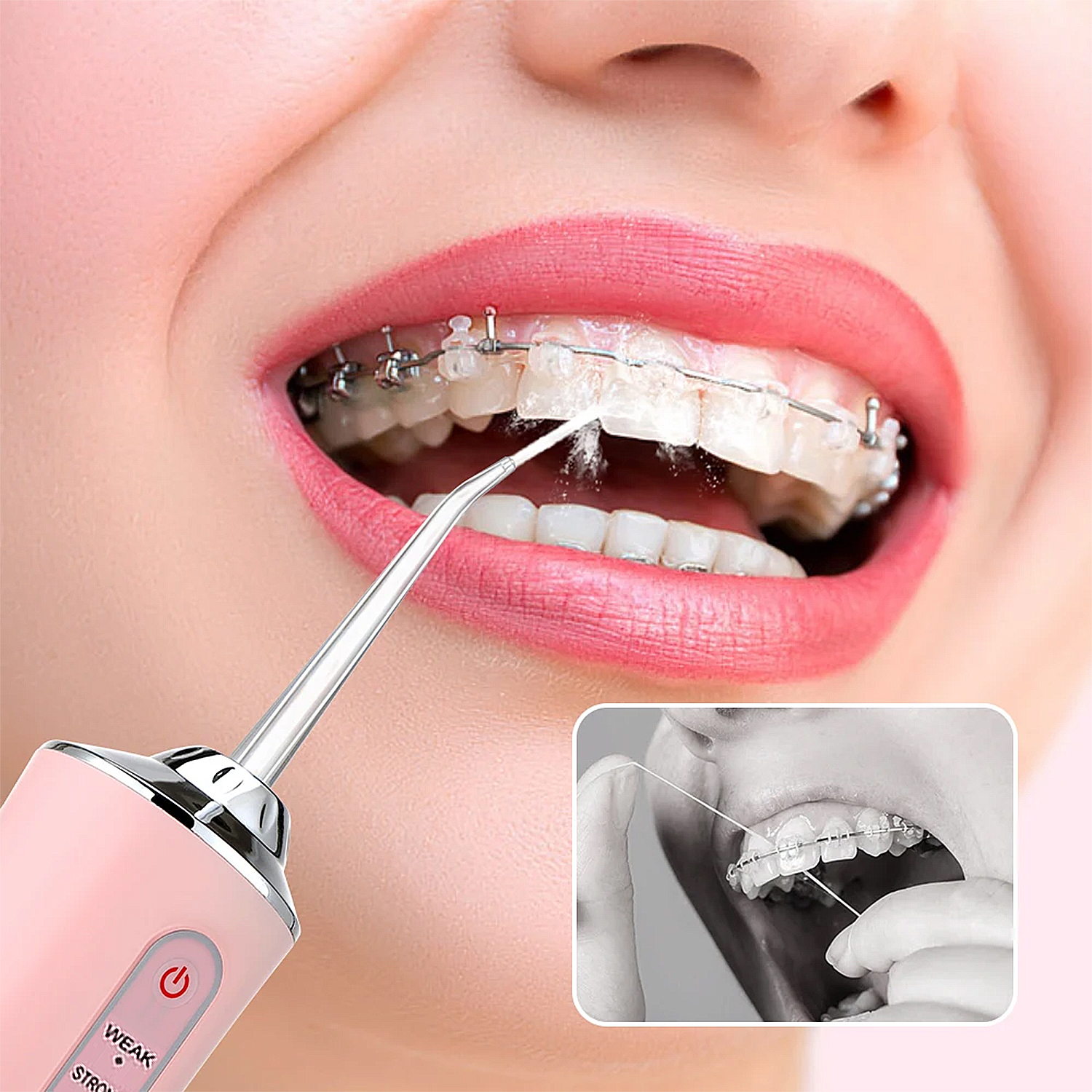 Persona con apparecchio usa idropulsore rosa per pulire i denti. Vista ravvicinata.