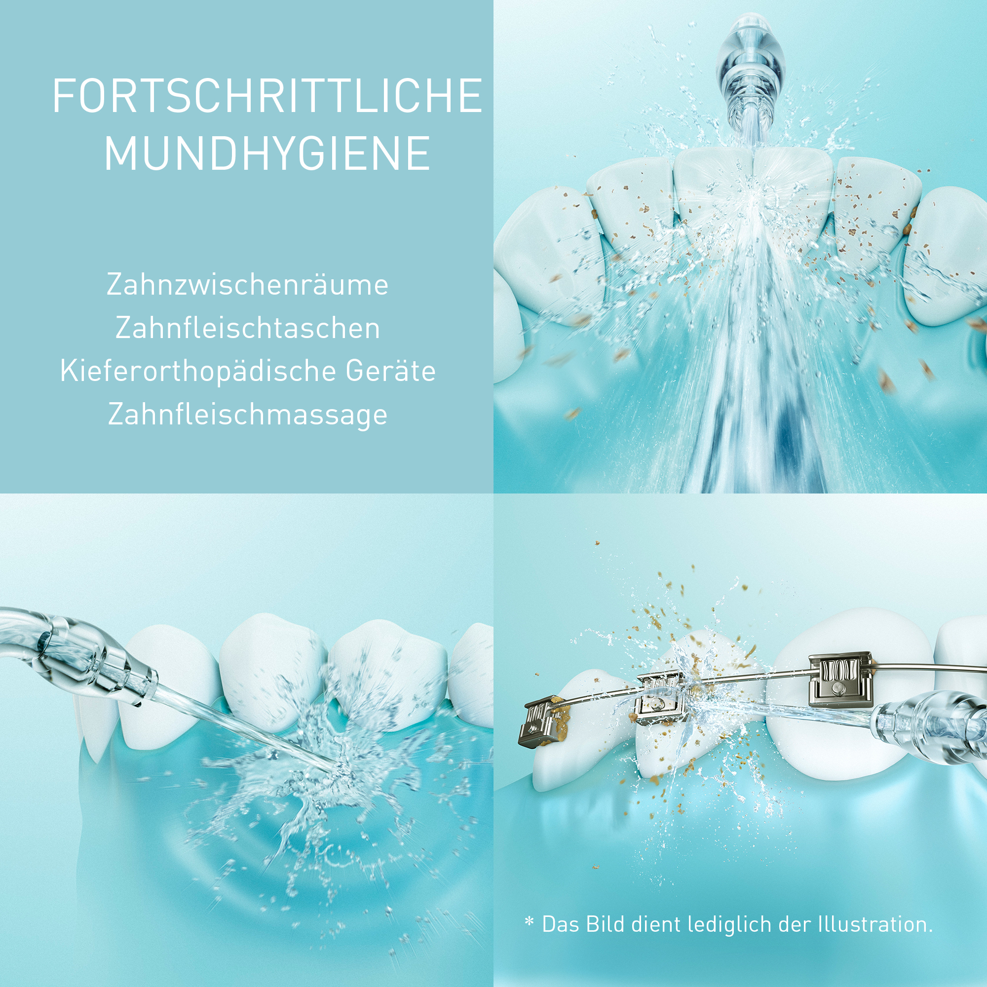 Strumień wody czyści zęby, dziąsła i aparaty. Zaawansowana higiena jamy ustnej.