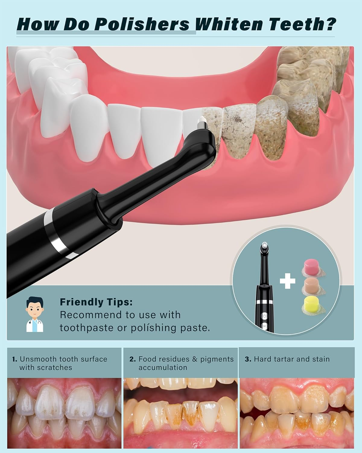 Illustration zeigt ein Dentalpoliergerät, das Zähne reinigt. Drei Bilder zeigen Zahnzustände.