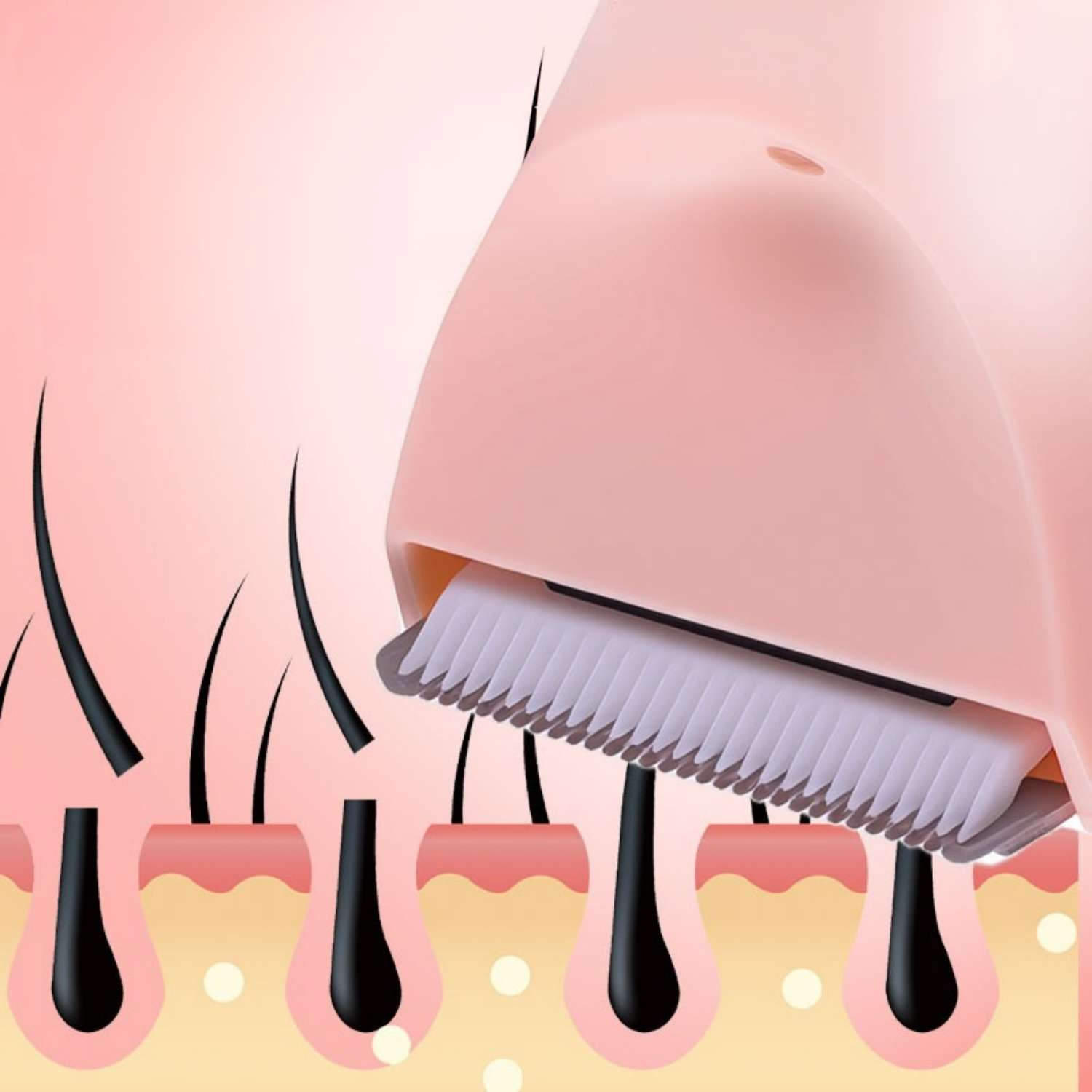 Ein rosa Trimmer schneidet schwarze Haare aus der Haut.
