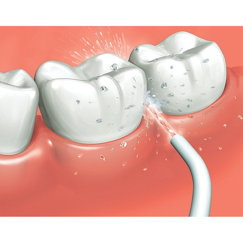 Un jet d'eau nettoie les dents et les gencives.