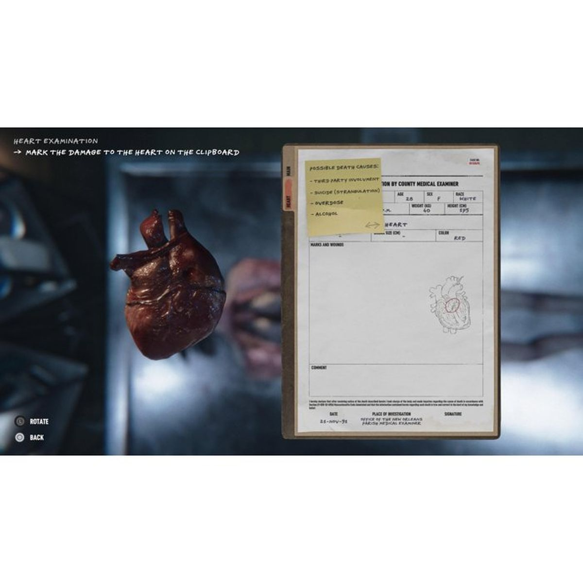 Un cuore è esposto accanto a un rapporto medico con le cause di morte.