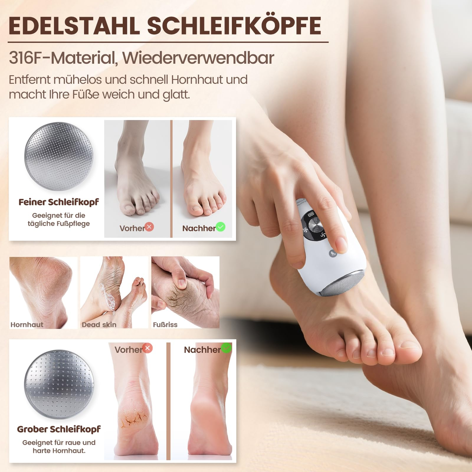 Eine Hand benutzt ein elektrisches Fußpflegegerät, um Hornhaut zu entfernen.