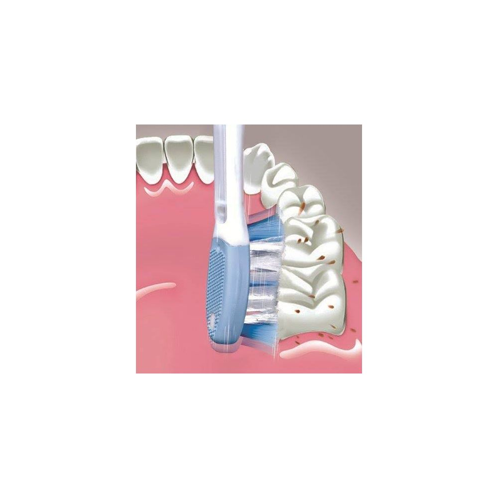 Szczoteczka do zębów czyści białe zęby z brązowymi plamami.