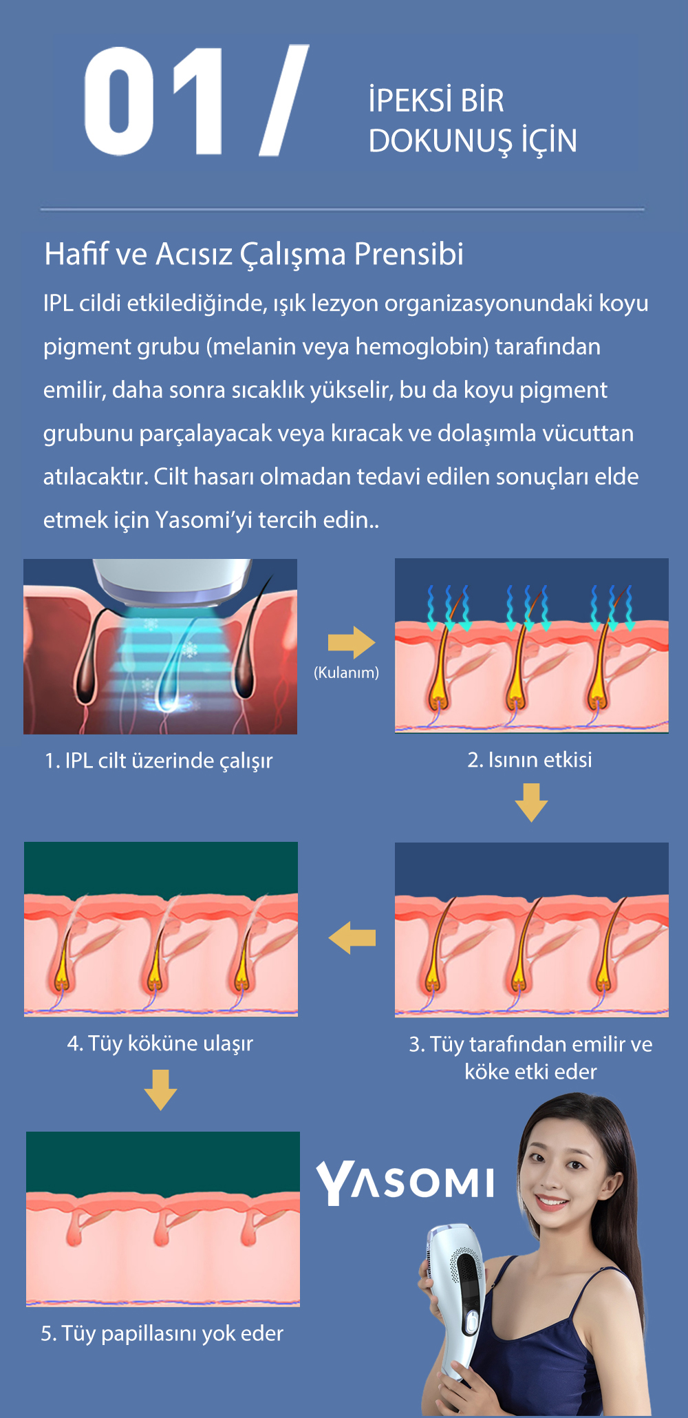 Diyagram IPL tüy alma işlemini gösterir: 1. Ciltte IPL, 2. Isı etkisi, 3. Tüy tarafından emilir, 4. Köküne ulaşır, 5. Papillayı yok eder.