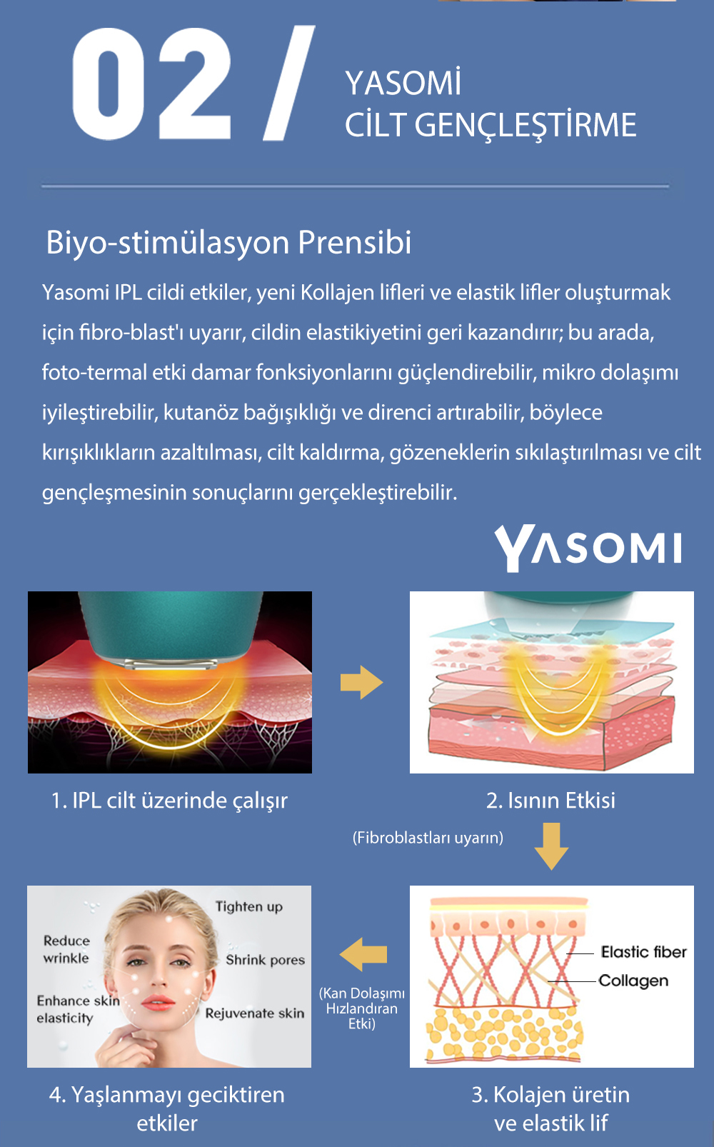 Grafik IPL cilt tedavisini gösterir: cilt katmanları, kollajen, elastik lifler.