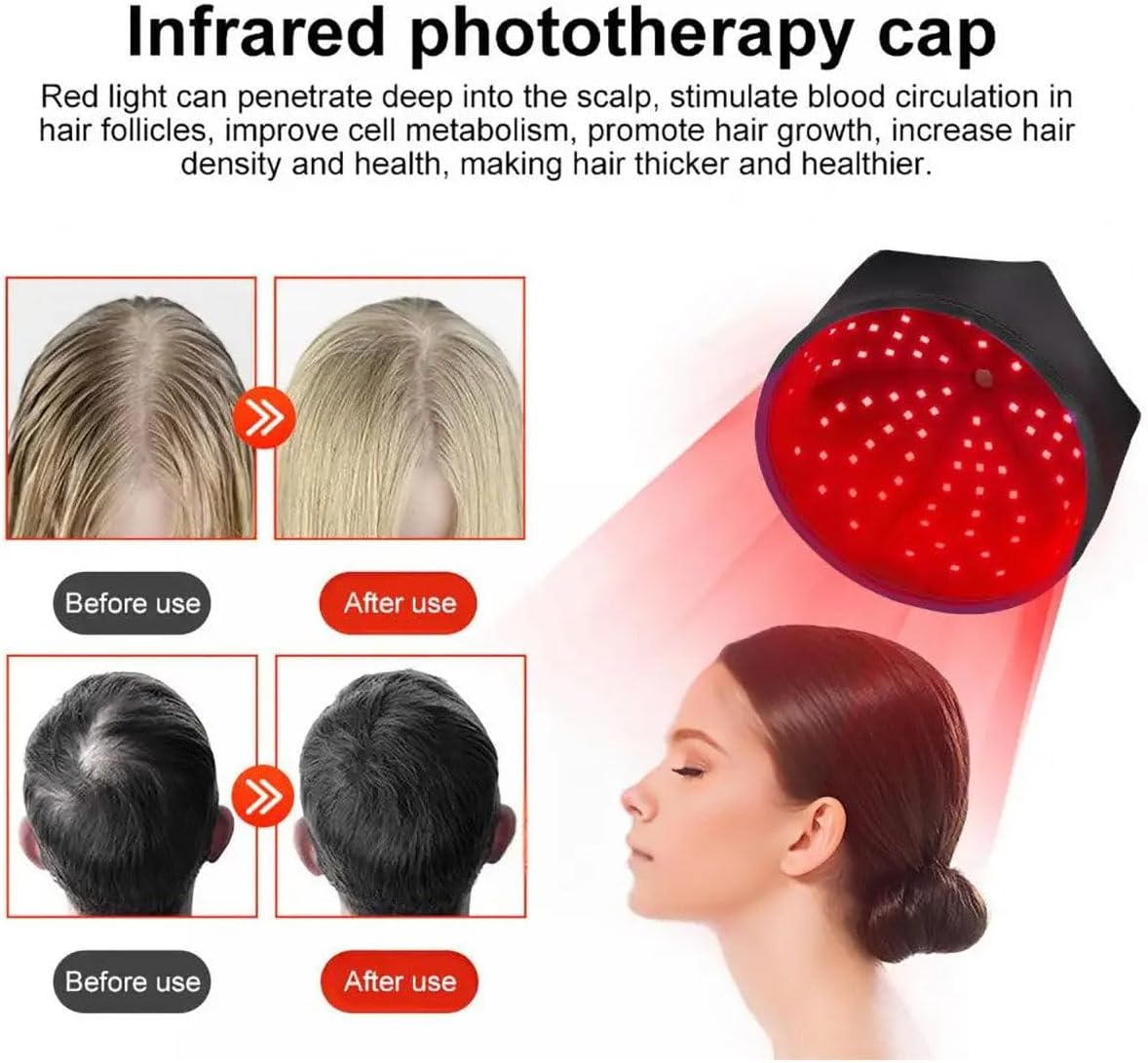 Infrarot-Phototherapie-Kappe mit rotem Licht, zeigt Vorher/Nachher-Haarwachstum.