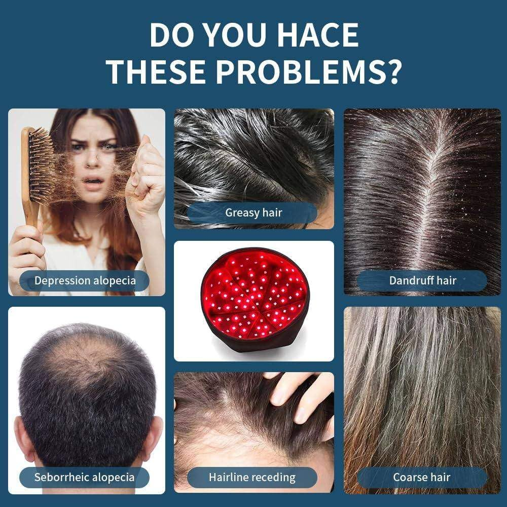 Collage von Haarproblemen: Alopezie, fettig, Schuppen, zurückgehender Haaransatz, grobes Haar, rote Laserkappe.