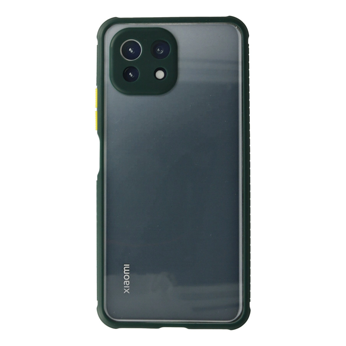 NEWFACE Xiaomi Mi 11 Lite Uyumlu Miami Şeffaf Silikon Telefon Kılıfı Koyu Yeşil