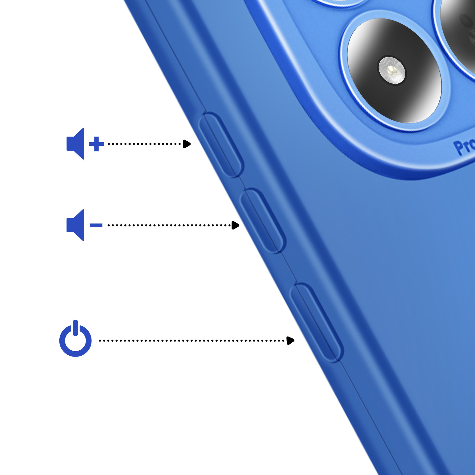 Coque de téléphone bleue montrant les boutons volume haut/bas et marche/arrêt.