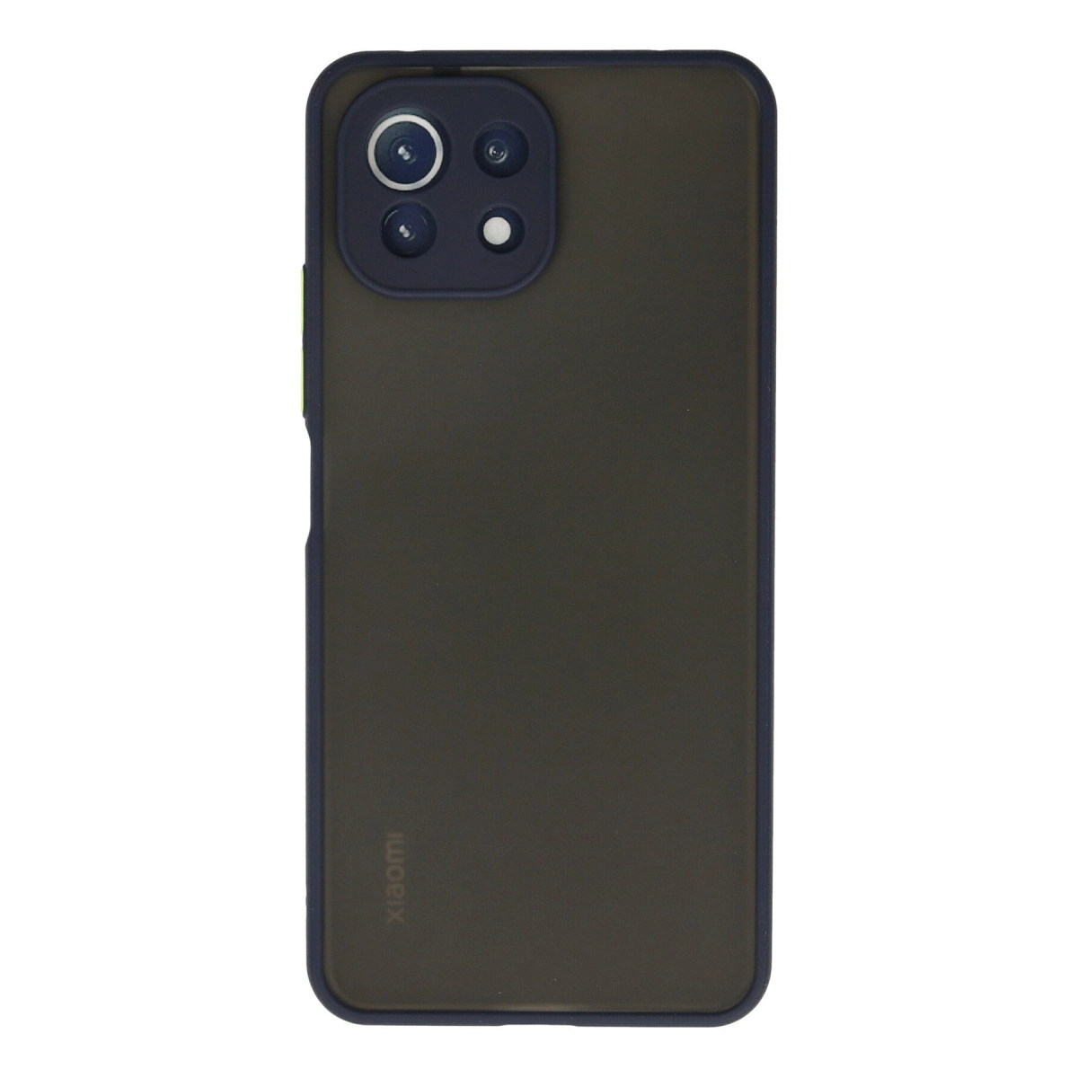 NEWFACE Xiaomi Mi 11 Lite Uyumlu Montreal Silikon Kapak Telefon Kılıfı Lacivert