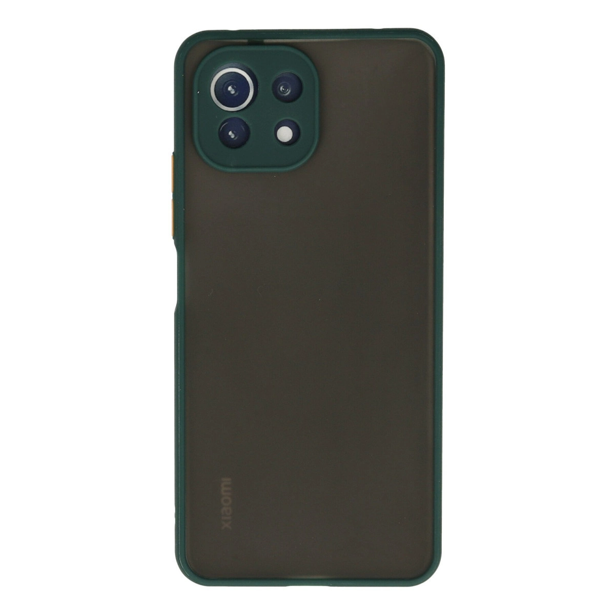 Dört kameralı ve arkasında Xiaomi logosu bulunan koyu yeşil telefon kılıfı.