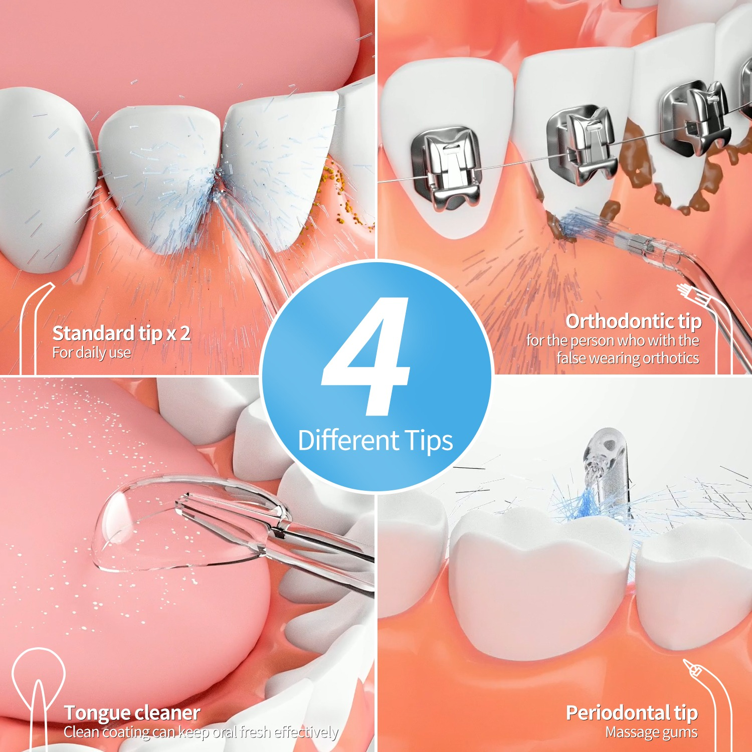 Cztery końcówki do higieny jamy ustnej: standardowa, ortodontyczna, do języka, przyzębia.