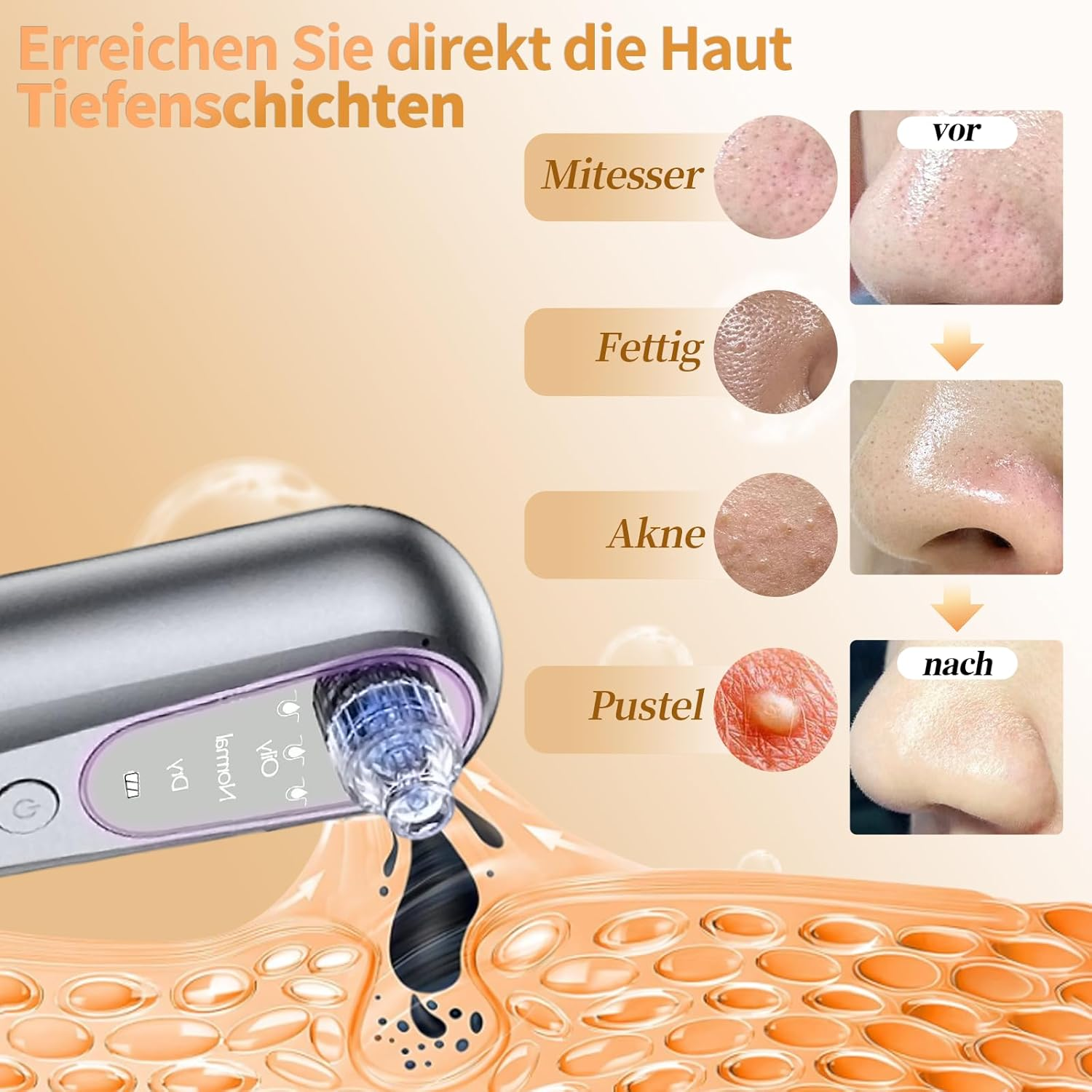 Ein Hautpflegegerät saugt Schmutz aus der Haut ab. Vorher/Nachher-Bilder zeigen die Wirkung.