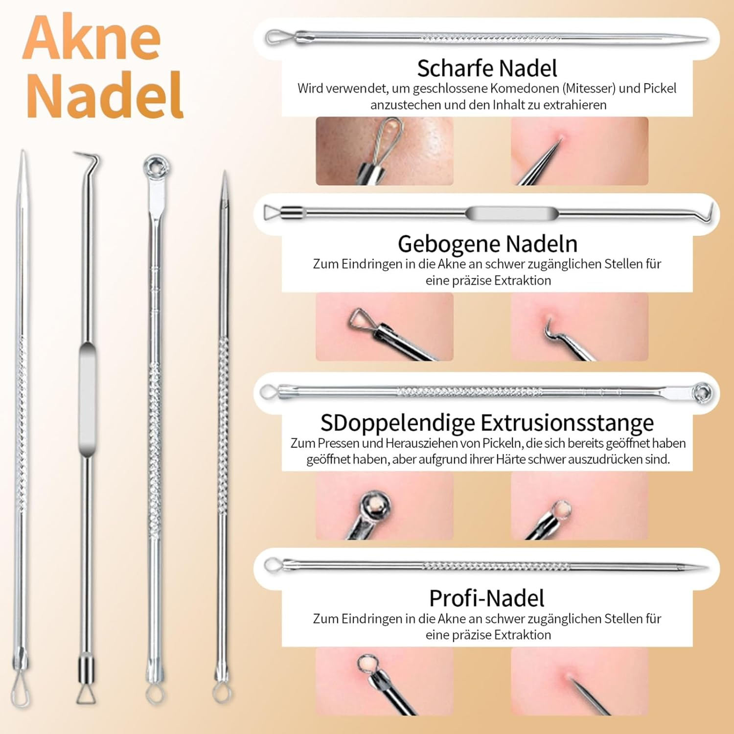 Akne-Nadel-Set mit verschiedenen Werkzeugen zur Hautpflege.