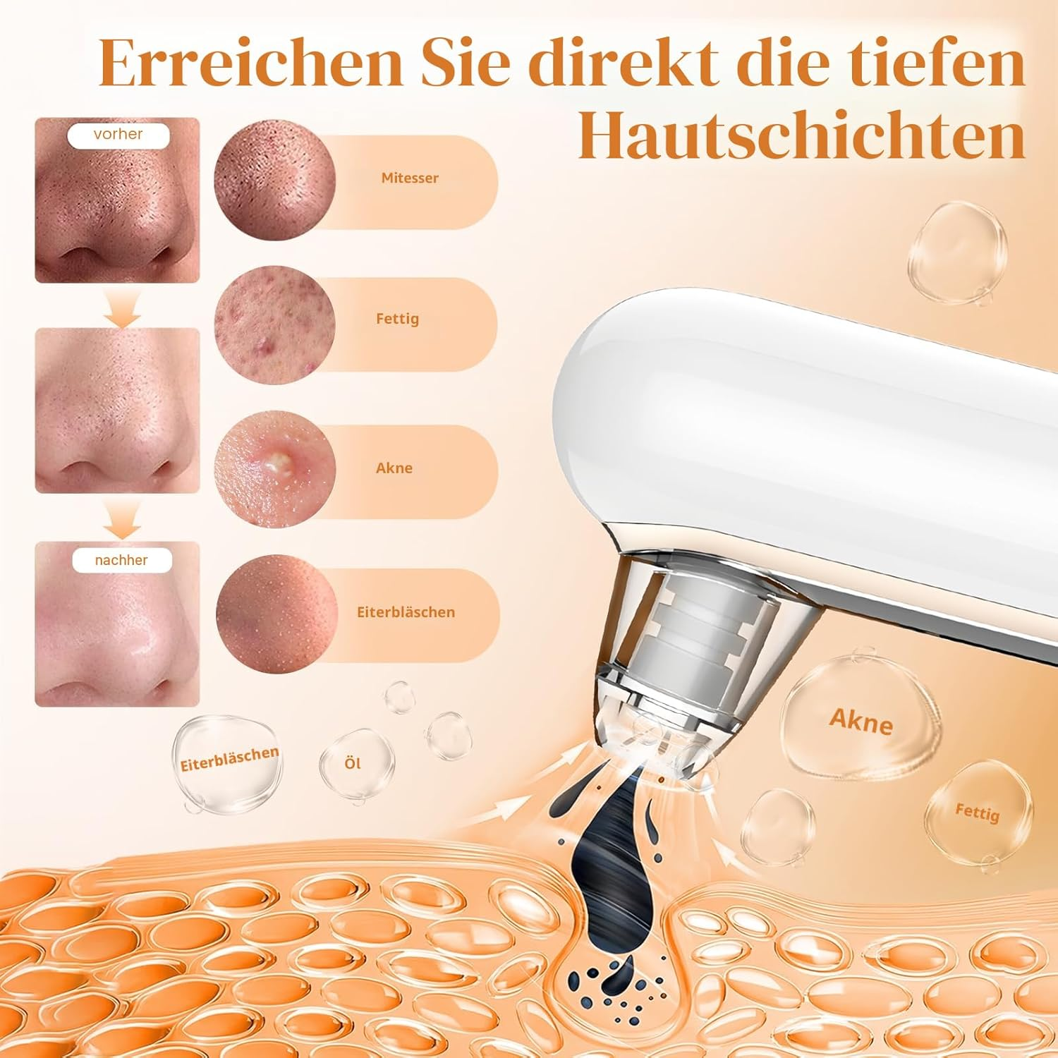 Vorher/Nachher-Vergleich von Hautproblemen wie Mitessern, Akne und Öl.