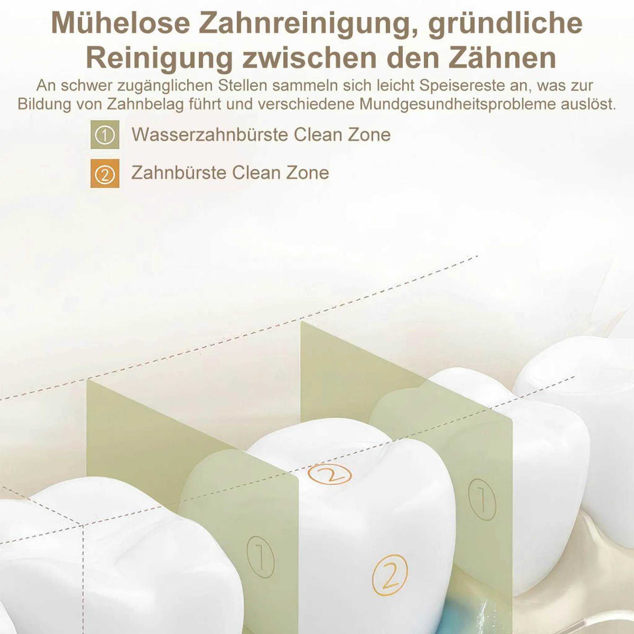 Nahaufnahme von Zähnen mit Markierungen für Reinigungszonen.